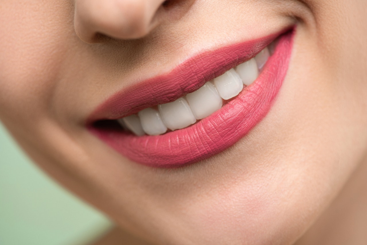 woman smiling with healthy strong teeth treated with fluoride