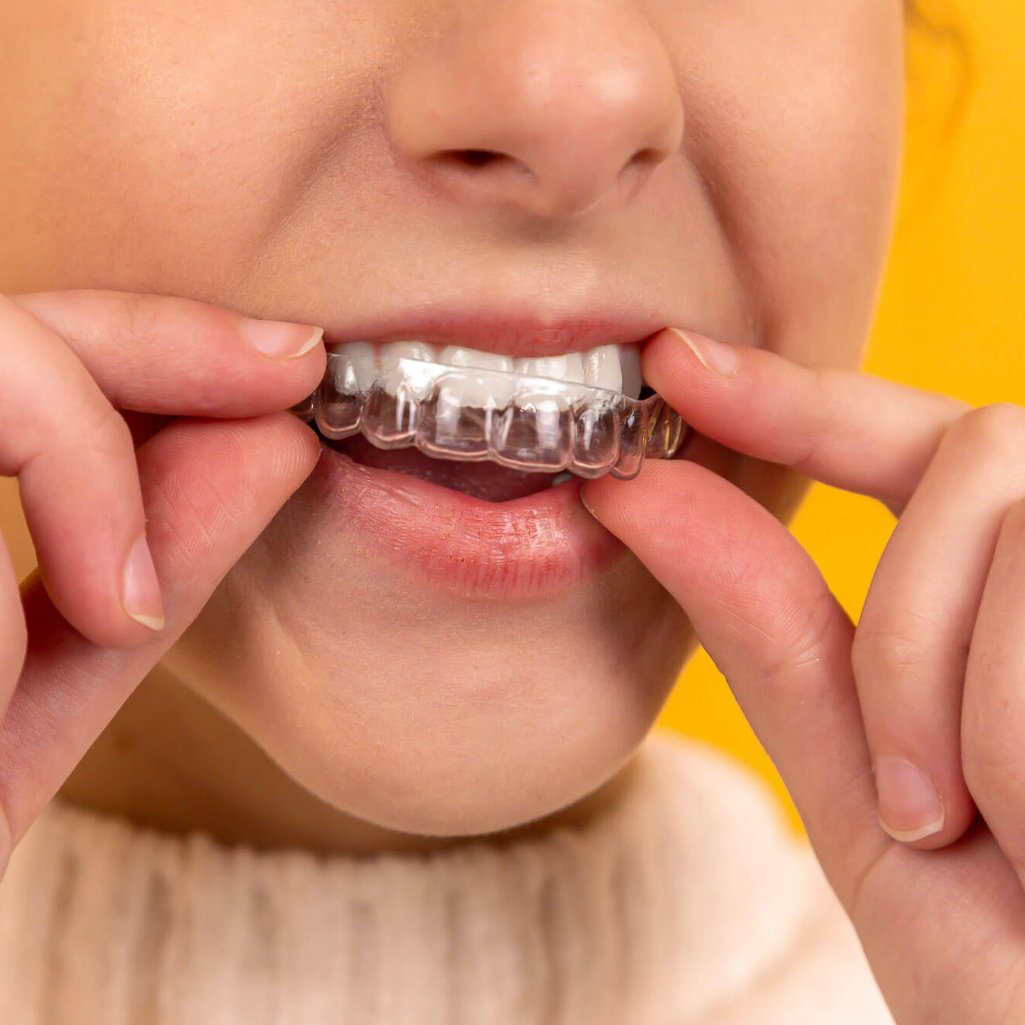 person putting on clear dental aligners